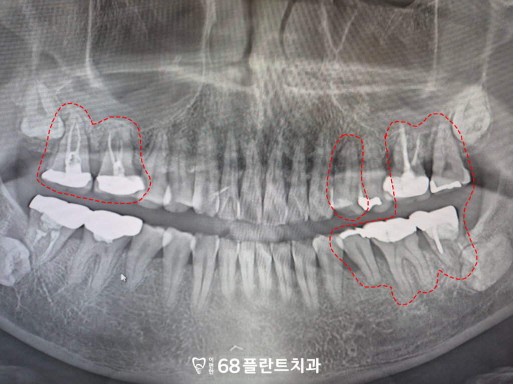 철산역임플란트