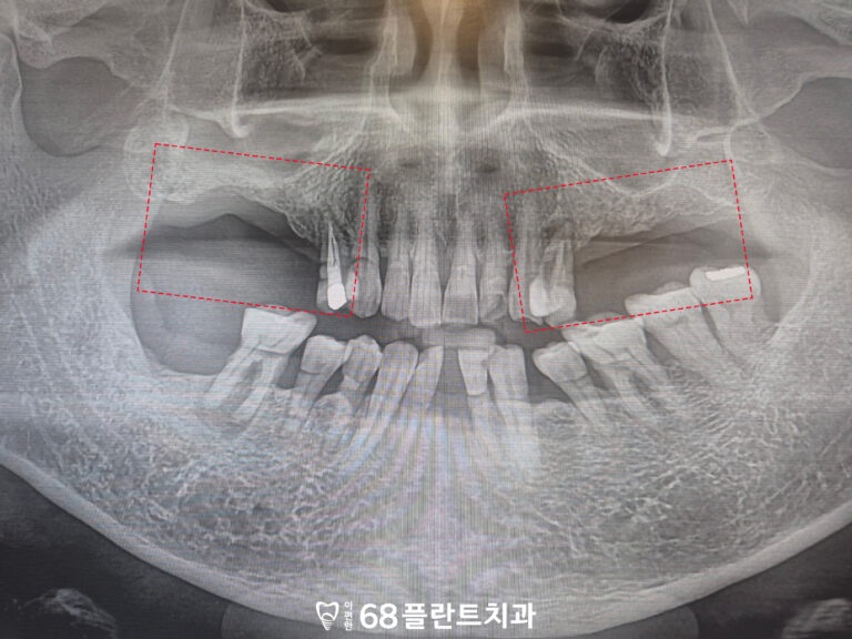 철산역치과