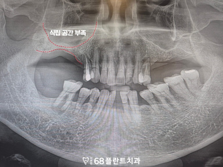 철산역치과