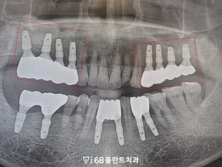 철산역치과