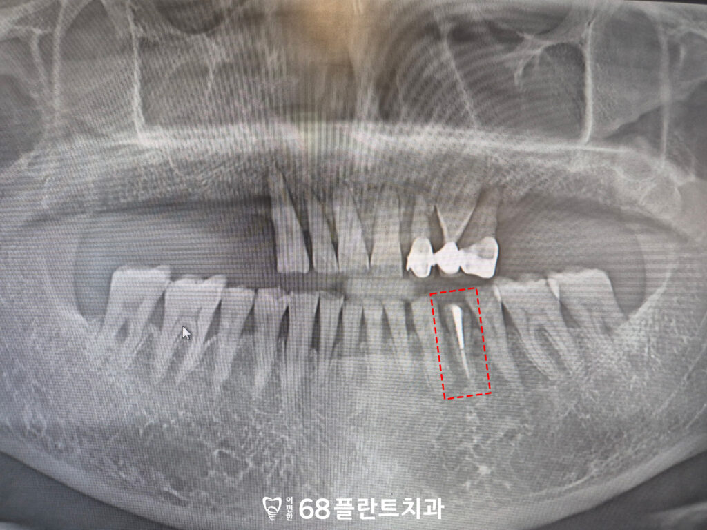 철산역임플란트