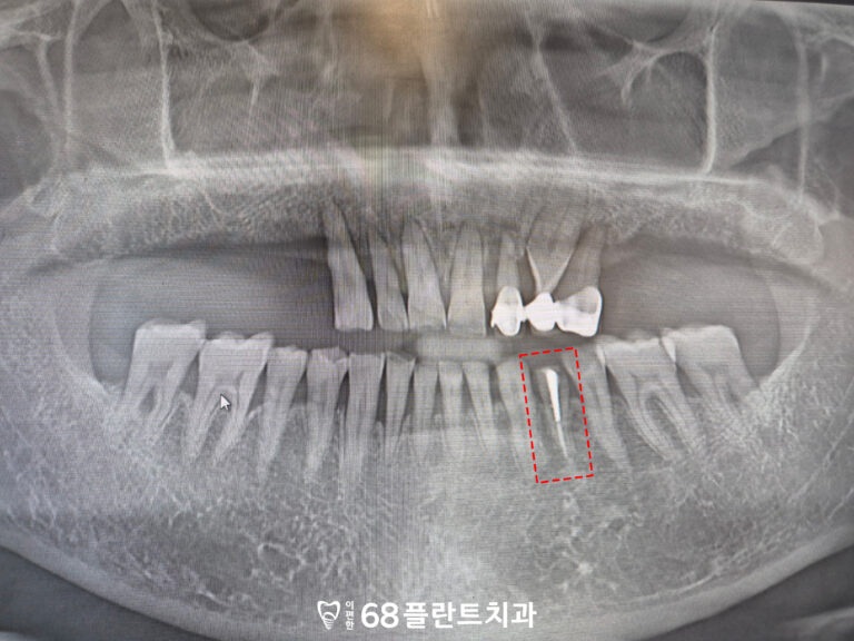 철산역임플란트