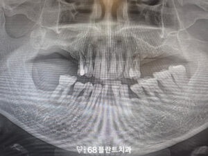 철산역치과