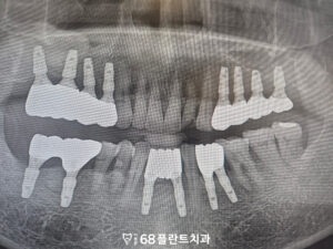 철산역치과