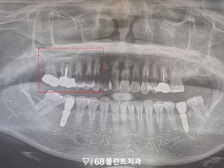 철산역치과
