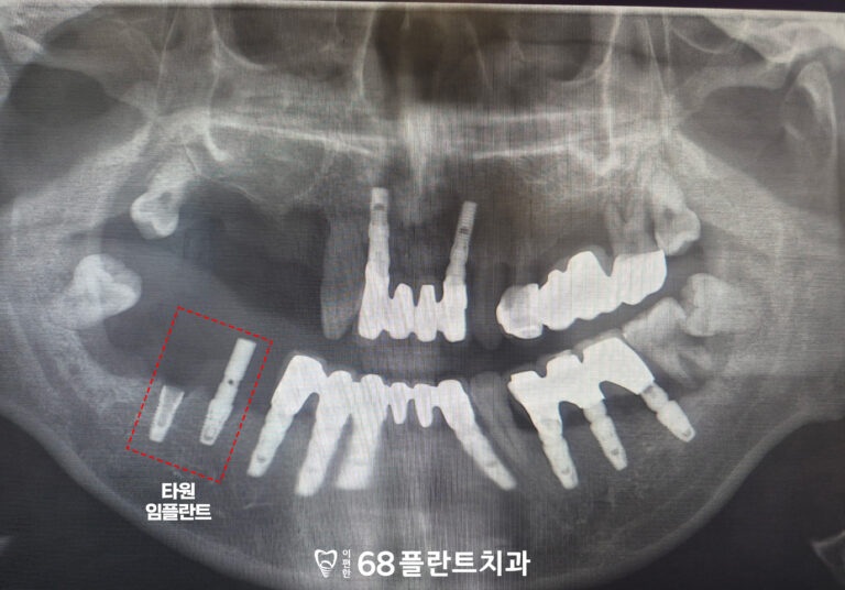 철산역치과