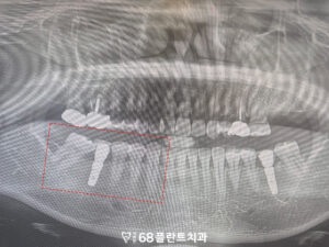 철산역치과