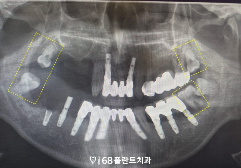 철산역치과