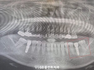 철산역치과