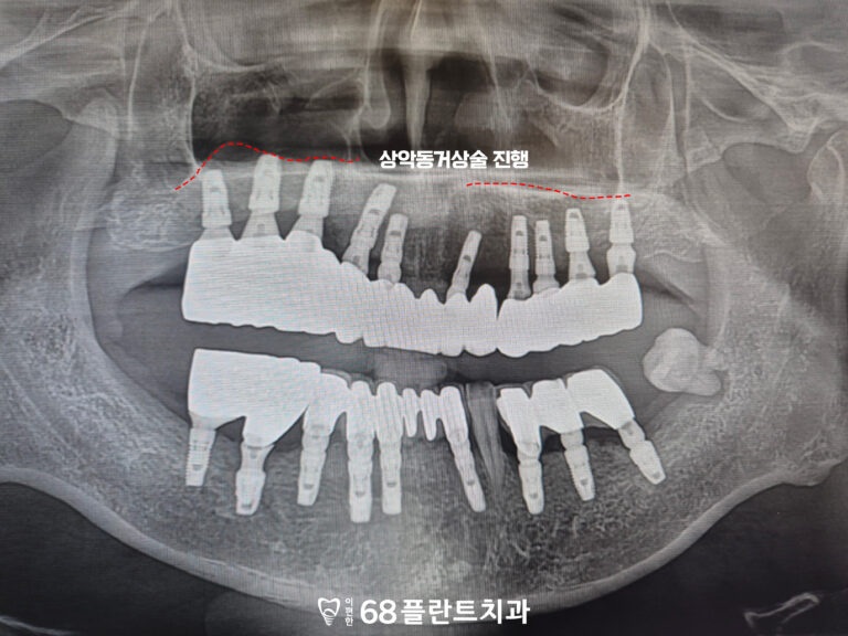 철산역치과