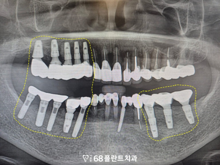 철산역치과