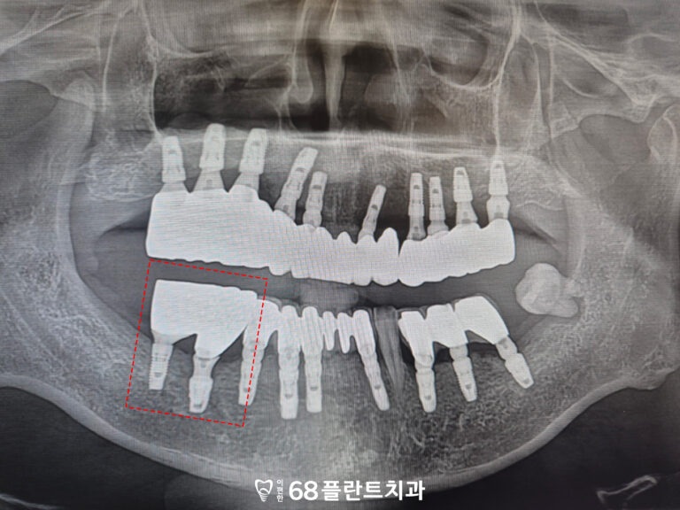 철산역치과
