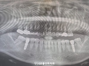 철산역치과