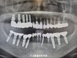 철산역치과