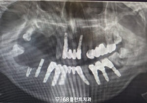 철산역치과