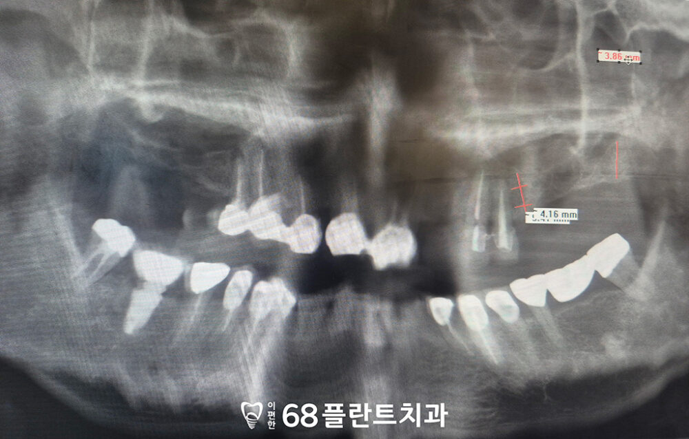 철산역치과
