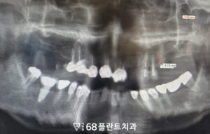 철산역치과