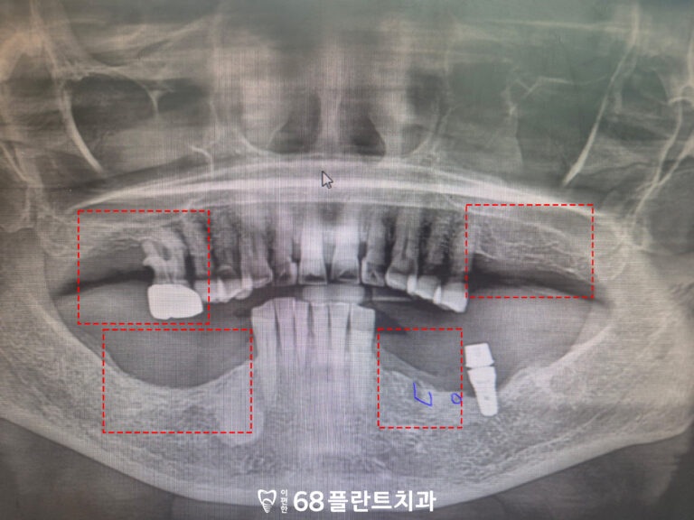 철산동치과