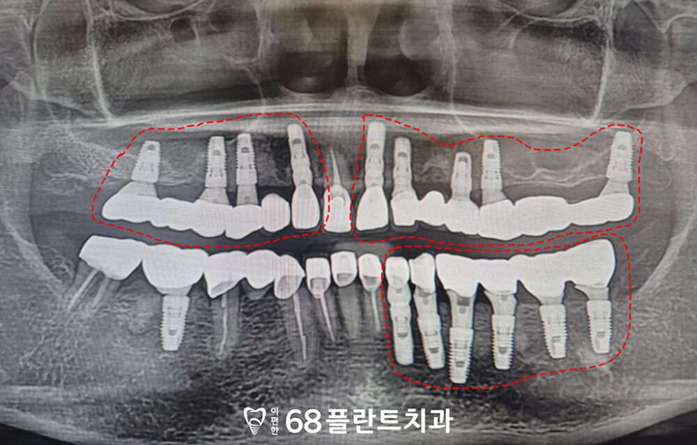 철산역치과
