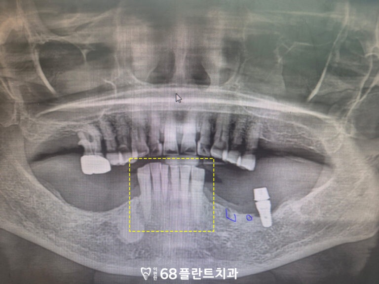 철산동치과