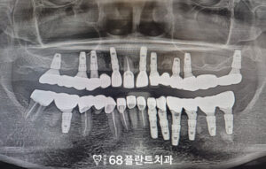 철산역치과