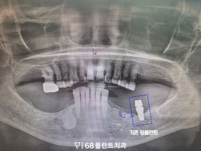 철산동치과