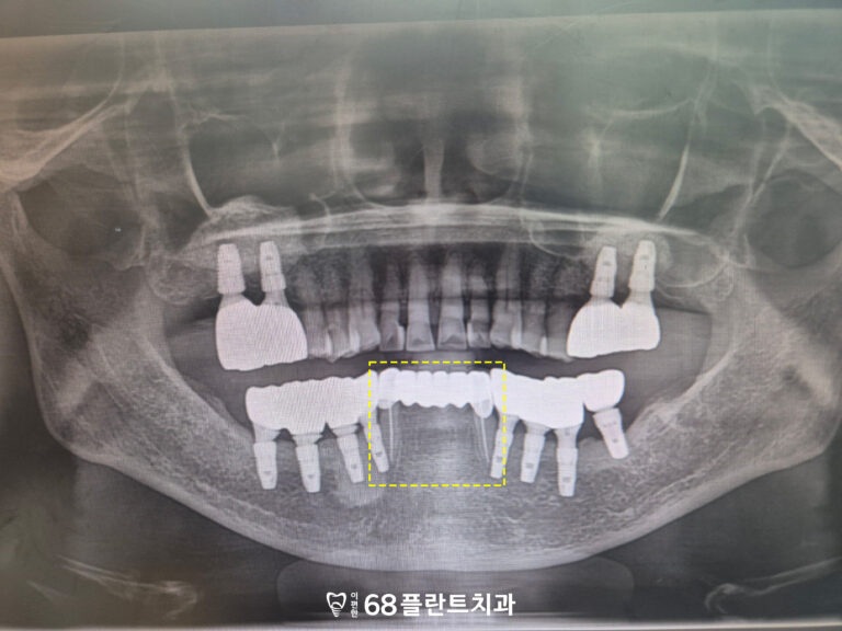 철산동치과