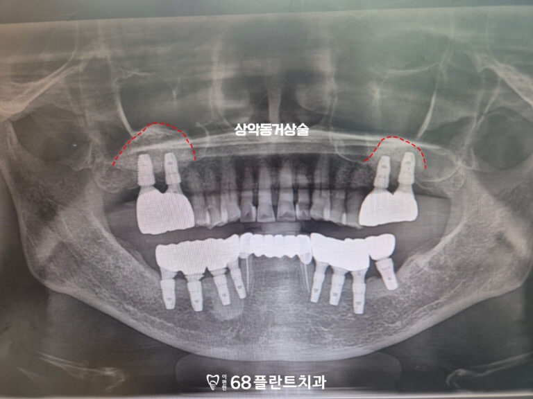 철산동치과