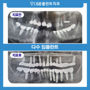 KakaoTalk_20260422_194827322_03