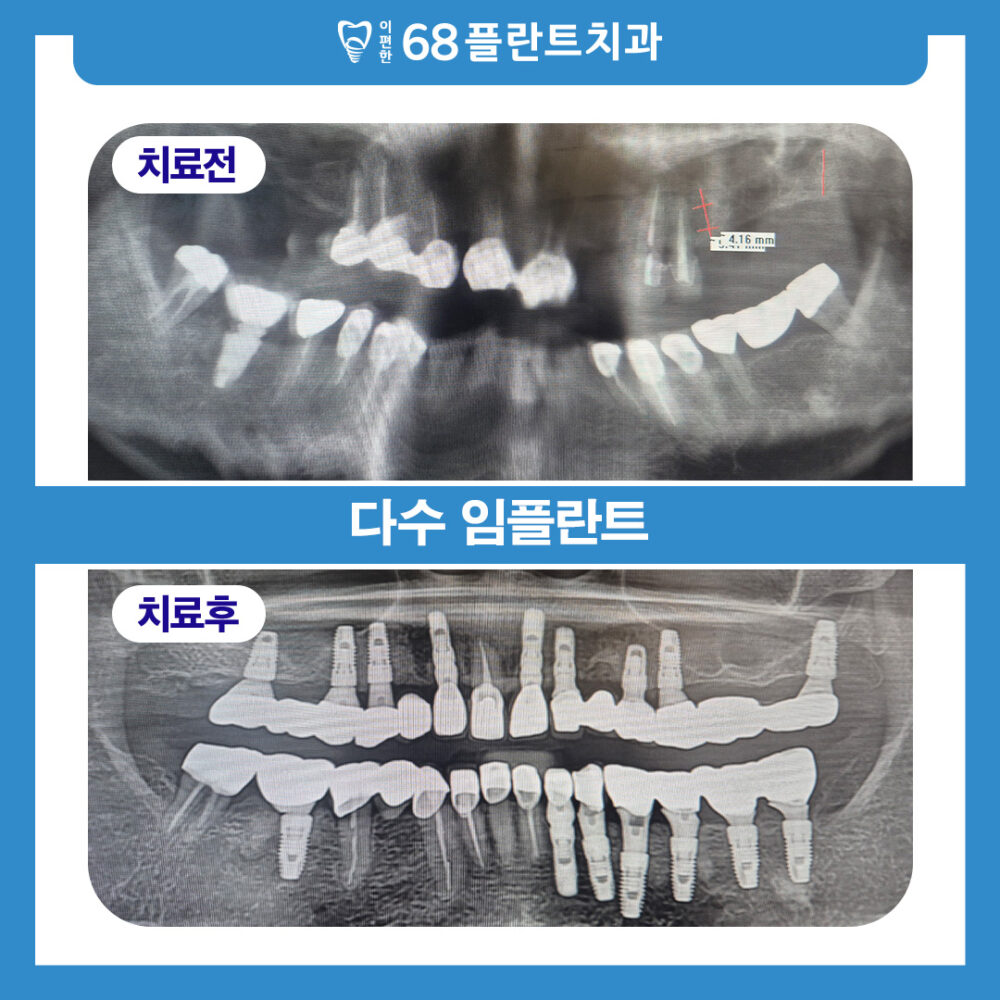 철산역치과