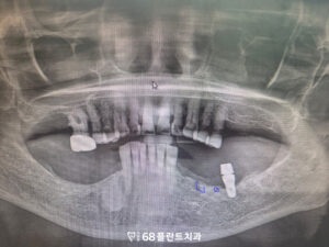 철산동치과