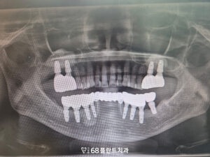 철산동치과