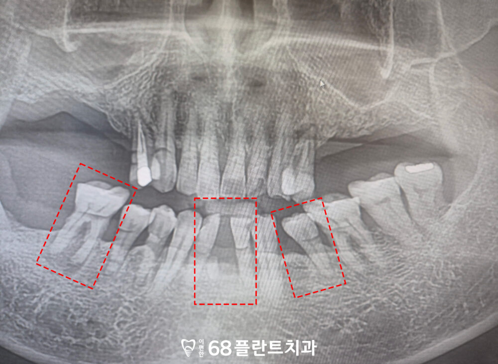 철산역치과
