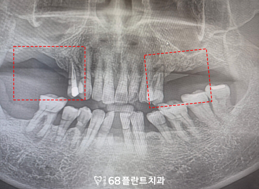 철산역치과