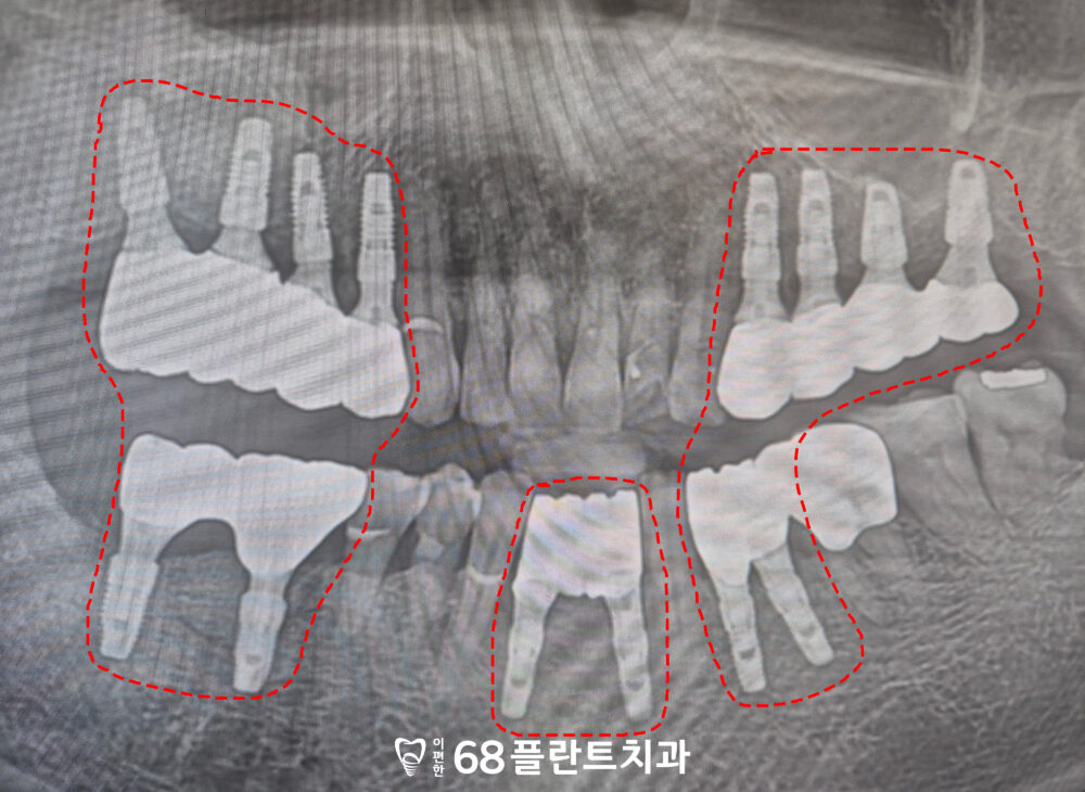 철산역치과