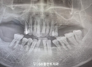 철산역치과