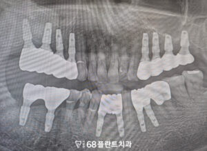 철산역치과