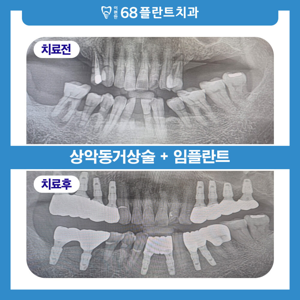 철산역치과