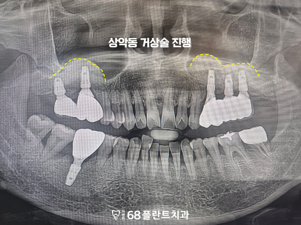 광명시치과