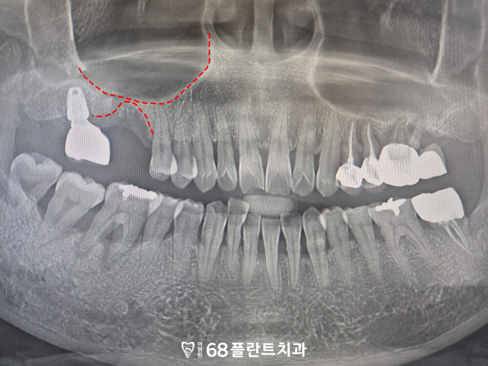 광명시치과