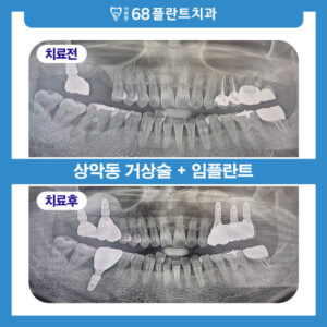 광명시치과_썸네일