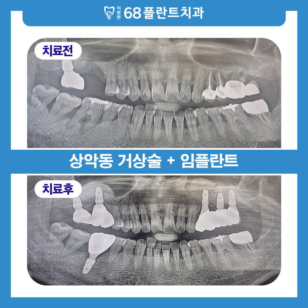 광명시치과