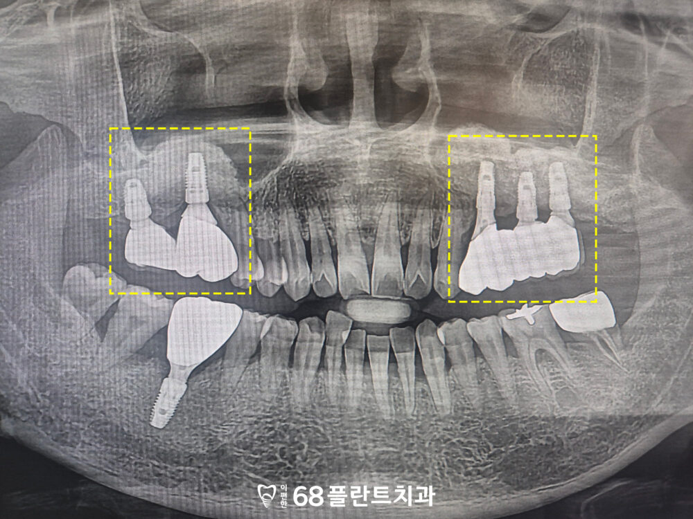 광명시치과