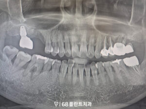 광명시치과