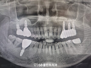 광명시치과