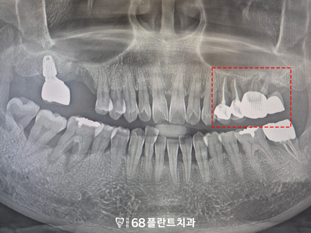 광명시치과