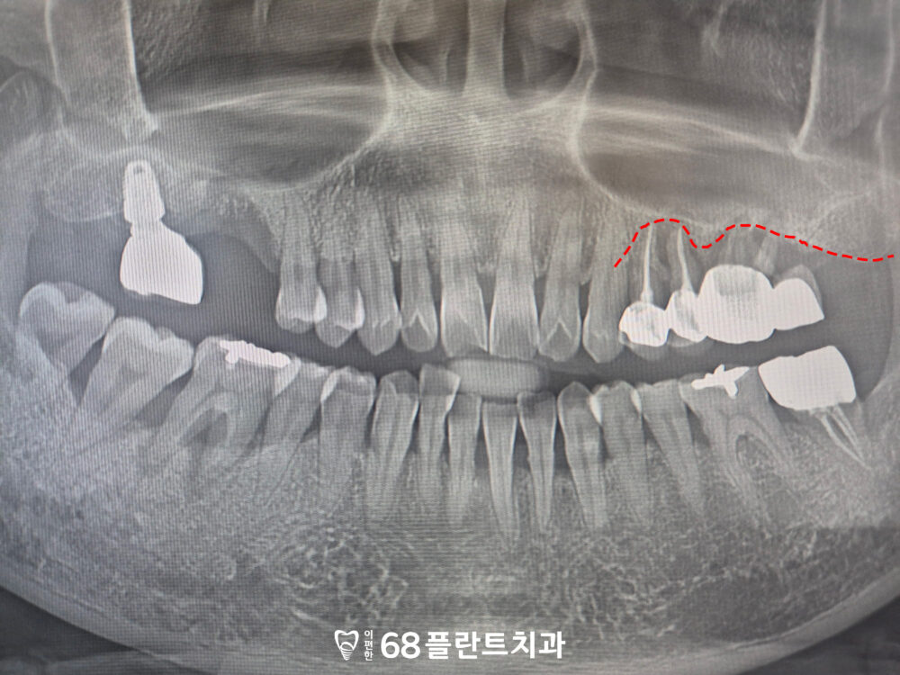 광명시치과